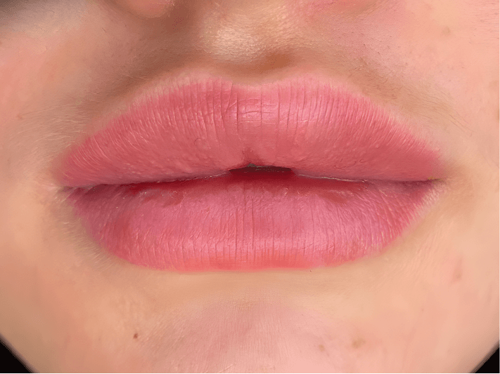 Перманент губ