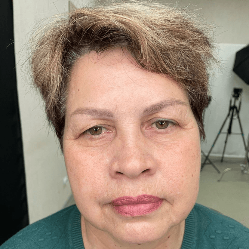 Коррекция формы