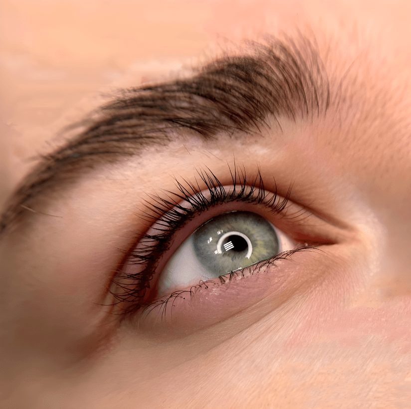 Результат межреснички