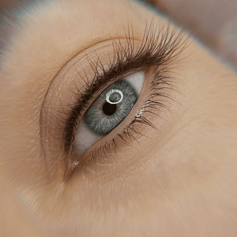 Естественная межресничка